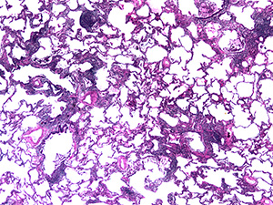 Pulmonary Pathology slide image - 1